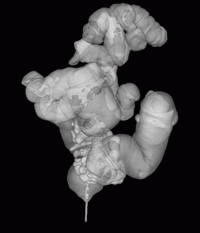 PIC
