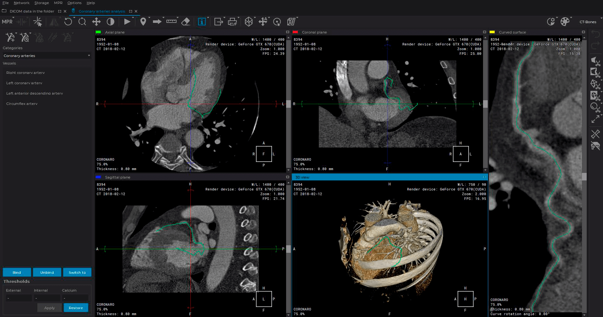 Dicom web viewer. ИНОБИТЕК Dicom-просмотрщик. ИНОБИТЕК просмотровщик. Inobitec Dicom viewer логотип.