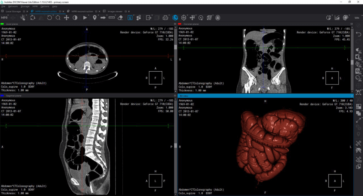 inobitec viewer lite photo